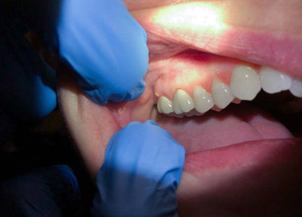 Best Emergency Dentist for Special Needs Patients in Berkeley, IL